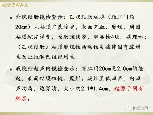 【病例】乙状结肠子宫内膜异位症1例CT诊断思路分析