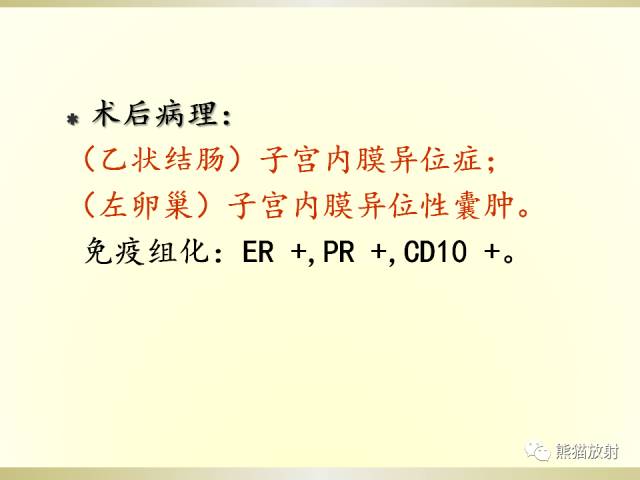 【病例】乙状结肠子宫内膜异位症1例CT诊断思路分析