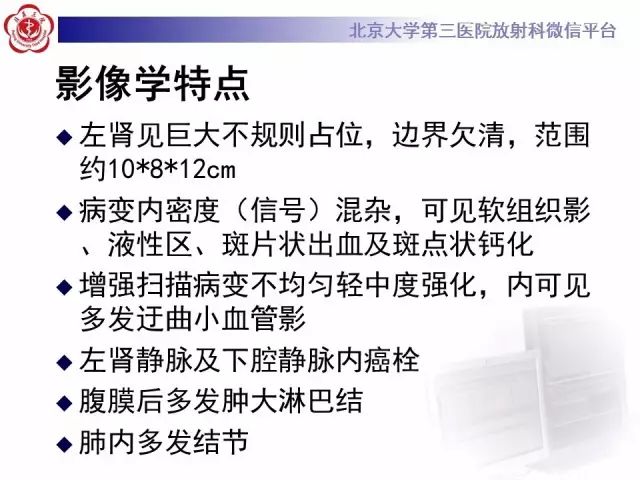 【病例】肾母细胞瘤1例CT影像表现