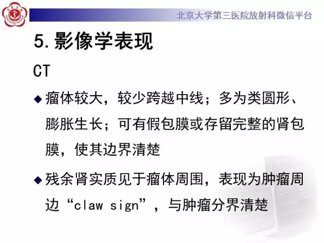 【病例】肾母细胞瘤1例CT影像表现