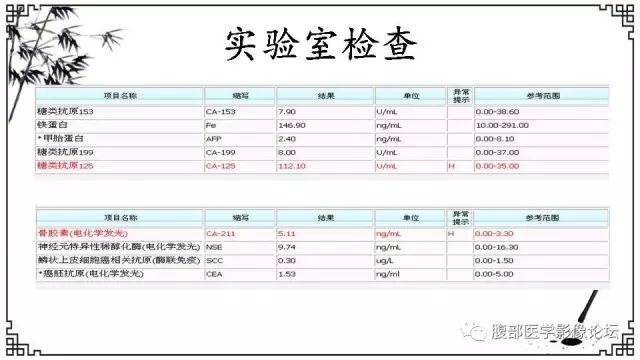 【病例】卵巢高级别浆液性癌1例CT及MR影像表现