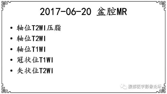 【病例】卵巢高级别浆液性癌1例CT及MR影像表现