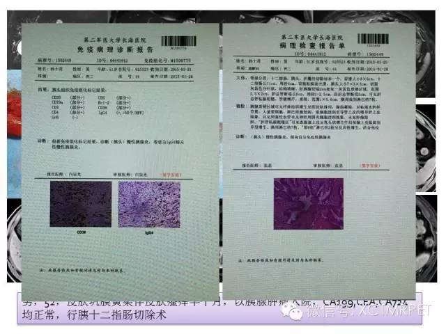 【PPT】肿块性胰腺炎影像诊断和鉴别诊断