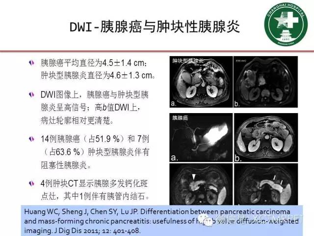 【PPT】肿块性胰腺炎影像诊断和鉴别诊断