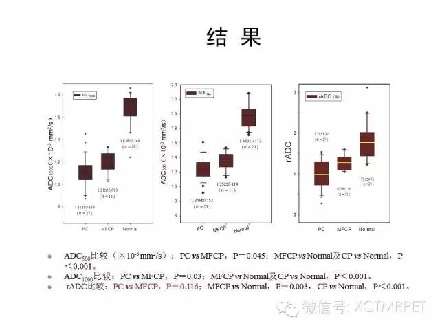【PPT】肿块性胰腺炎影像诊断和鉴别诊断