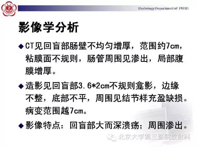 【病例】肠道白塞氏病1例X线CT