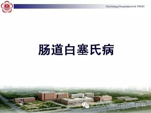 【病例】肠道白塞氏病1例X线CT