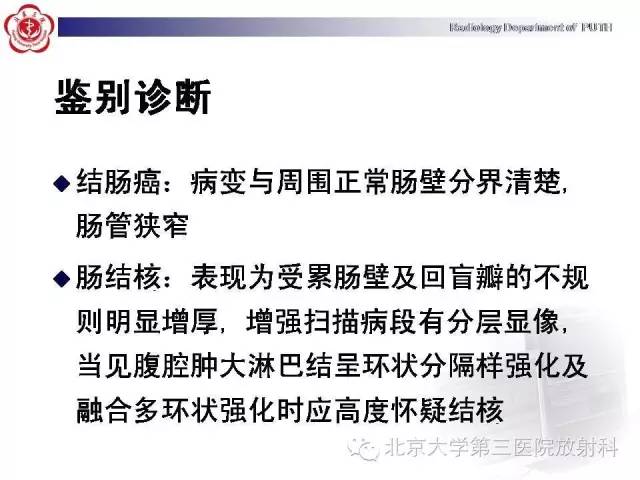 【病例】肠道白塞氏病1例X线CT