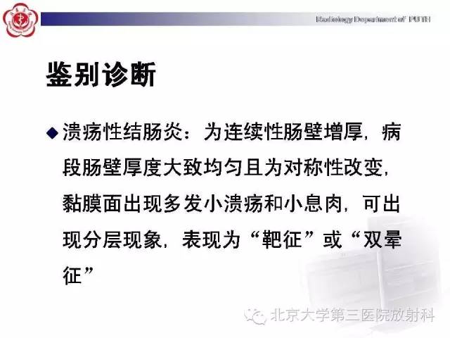 【病例】肠道白塞氏病1例X线CT