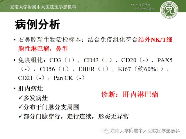 【病例】肝淋巴瘤1例CT影像表现