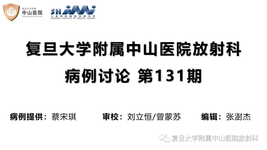 【病例】子宫腺肌瘤1例MR影像