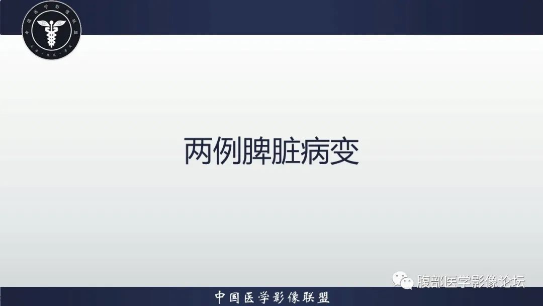 【病例】脾脏窦岸细胞血管瘤2例影像诊断-2