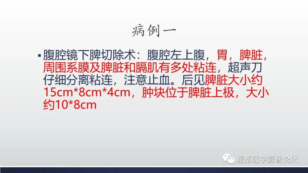 【病例】脾脏窦岸细胞血管瘤2例影像诊断-17