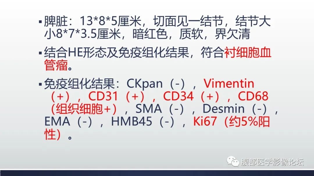 【病例】脾脏窦岸细胞血管瘤2例影像诊断-18