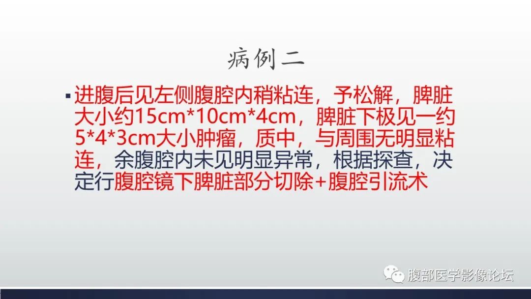 【病例】脾脏窦岸细胞血管瘤2例影像诊断-20