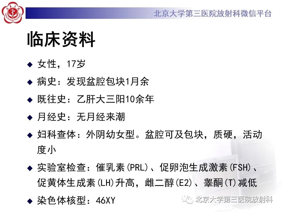 【PPT】卵巢无性细胞瘤-2