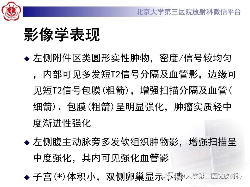 【PPT】卵巢无性细胞瘤-8