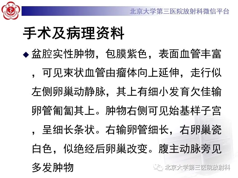 【PPT】卵巢无性细胞瘤-10