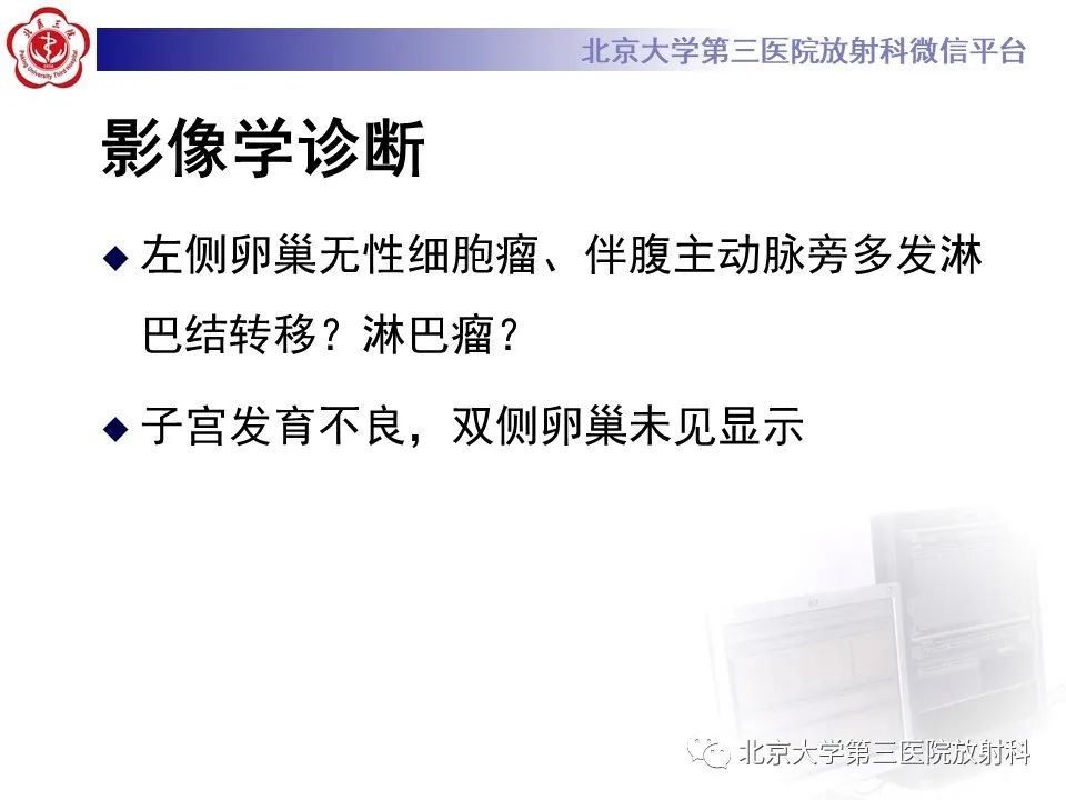 【PPT】卵巢无性细胞瘤-9