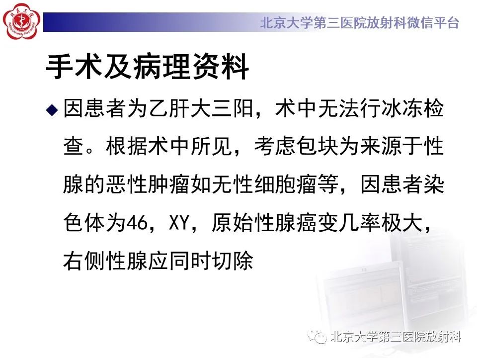 【PPT】卵巢无性细胞瘤-11