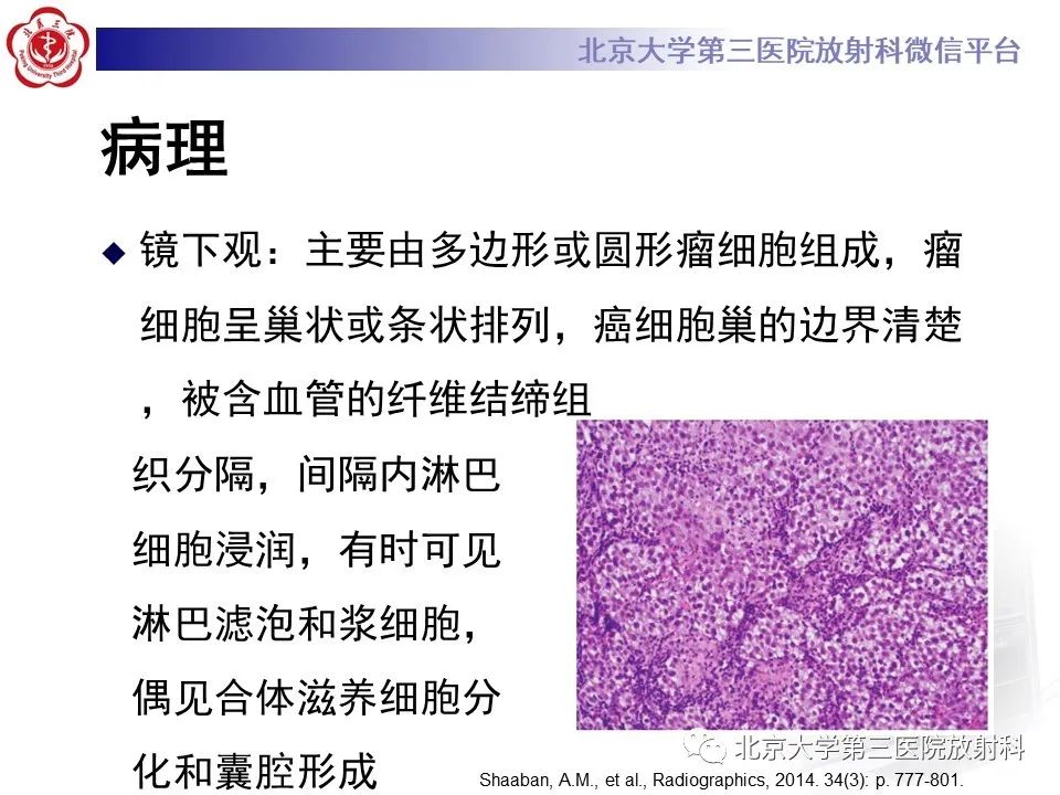 【PPT】卵巢无性细胞瘤-18