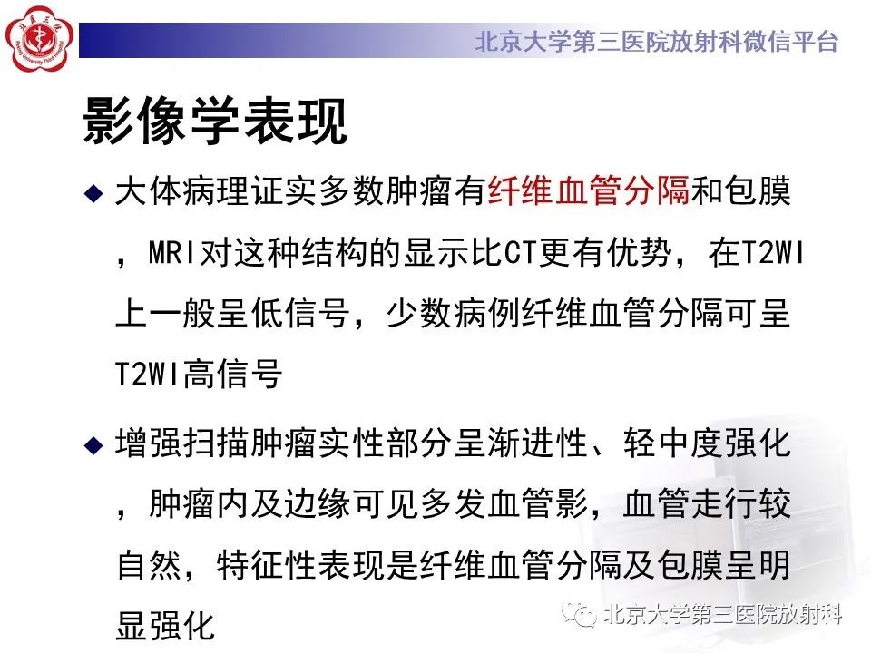 【PPT】卵巢无性细胞瘤-21