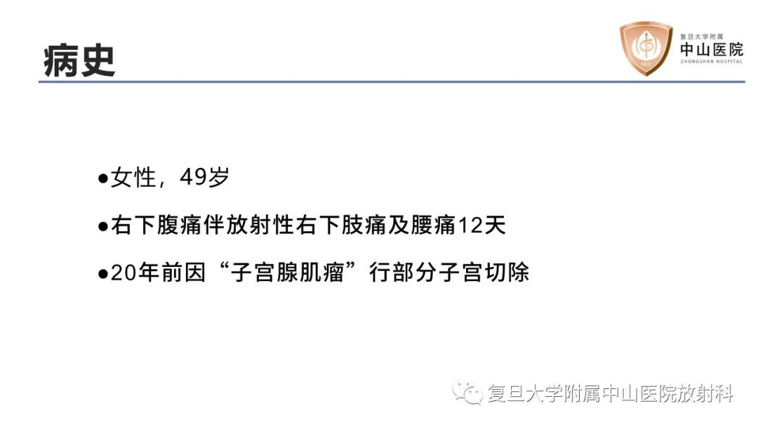 【病例】子宫腺肌瘤1例MR影像-2