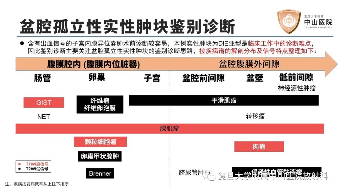 【病例】子宫腺肌瘤1例MR影像-18