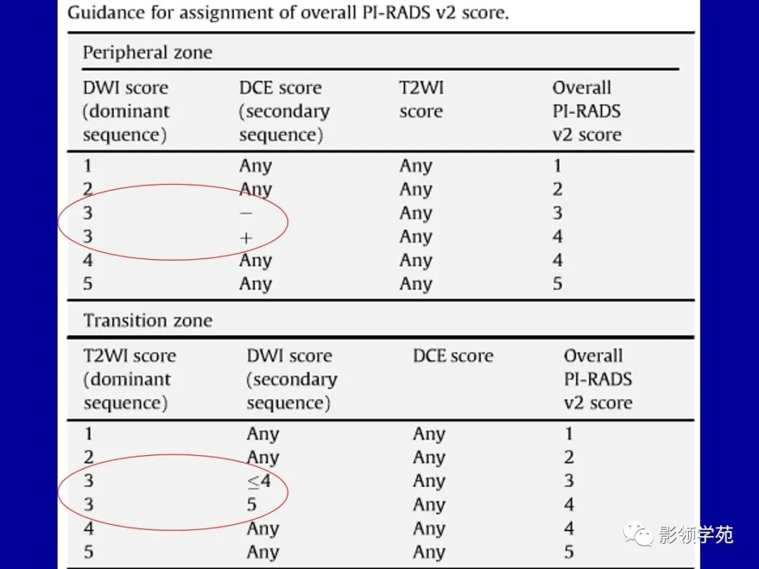 【PPT】前列腺癌MRI诊断再认识-15