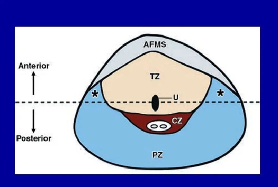 【PPT】前列腺癌MRI诊断再认识-26