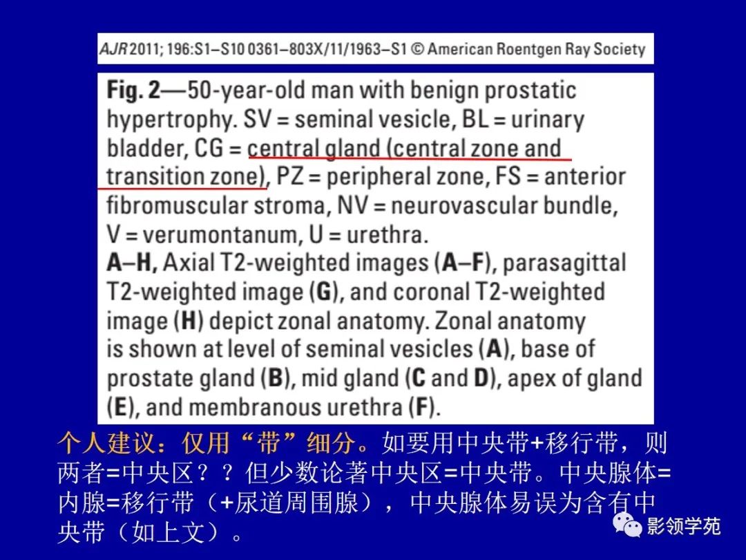 【PPT】前列腺癌MRI诊断再认识-28