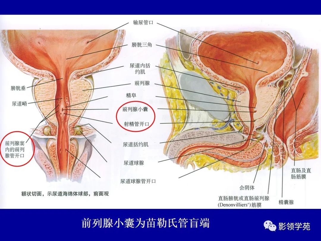 【PPT】前列腺癌MRI诊断再认识-30