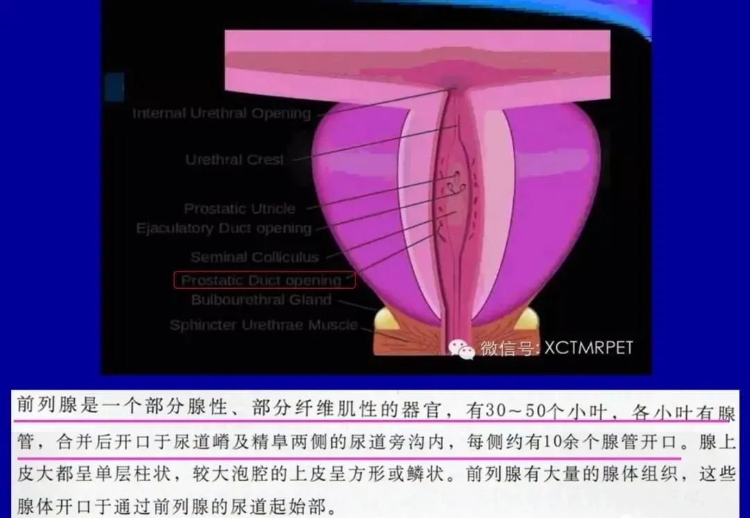 【PPT】前列腺癌MRI诊断再认识-31
