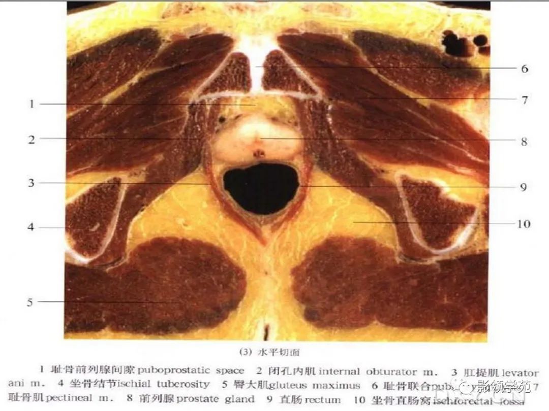 【PPT】前列腺癌MRI诊断再认识-32