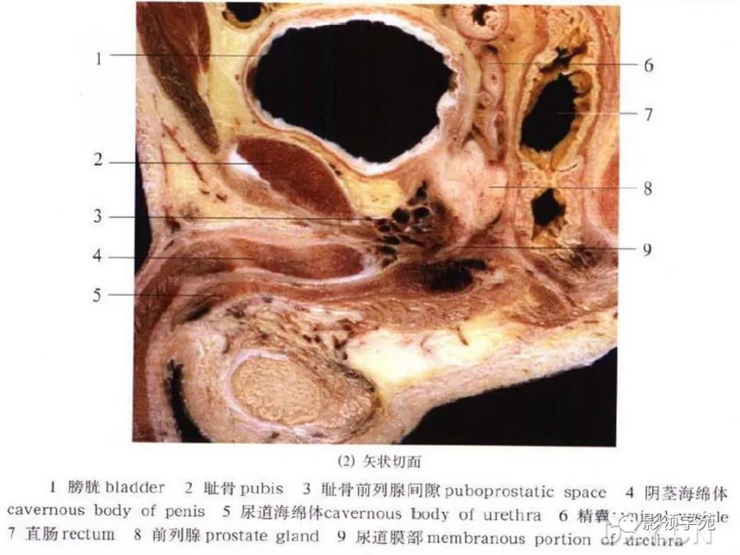 【PPT】前列腺癌MRI诊断再认识-34