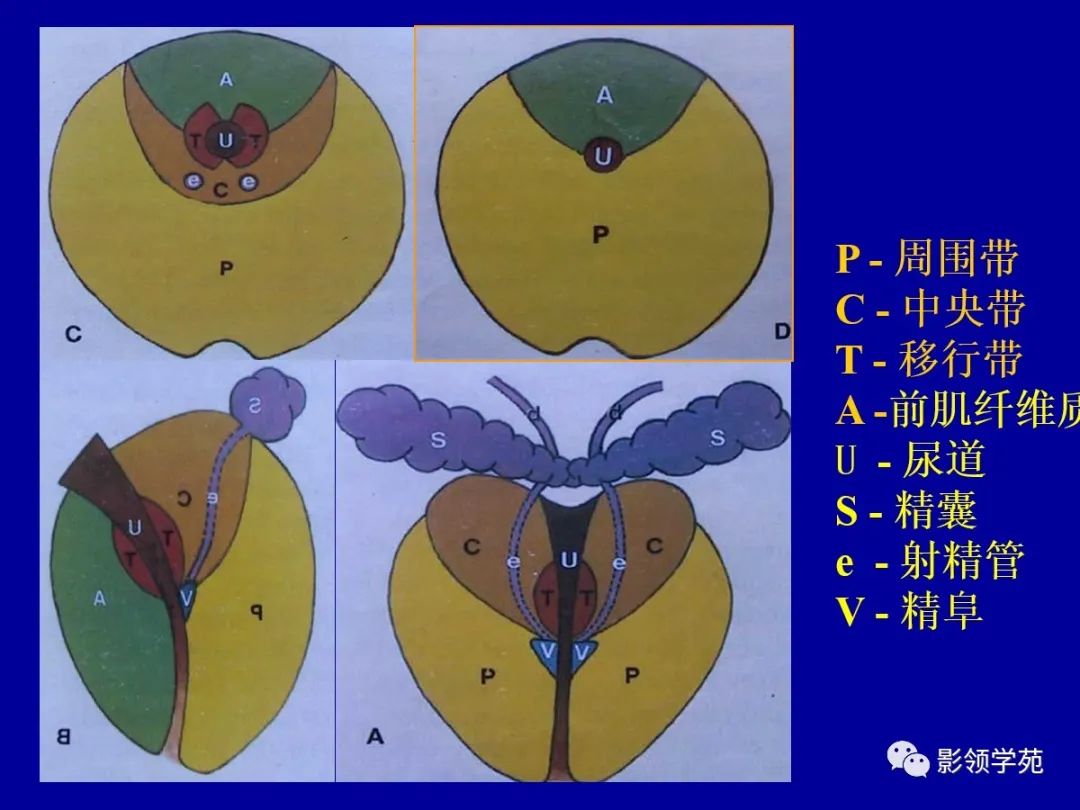 【PPT】前列腺癌MRI诊断再认识-35