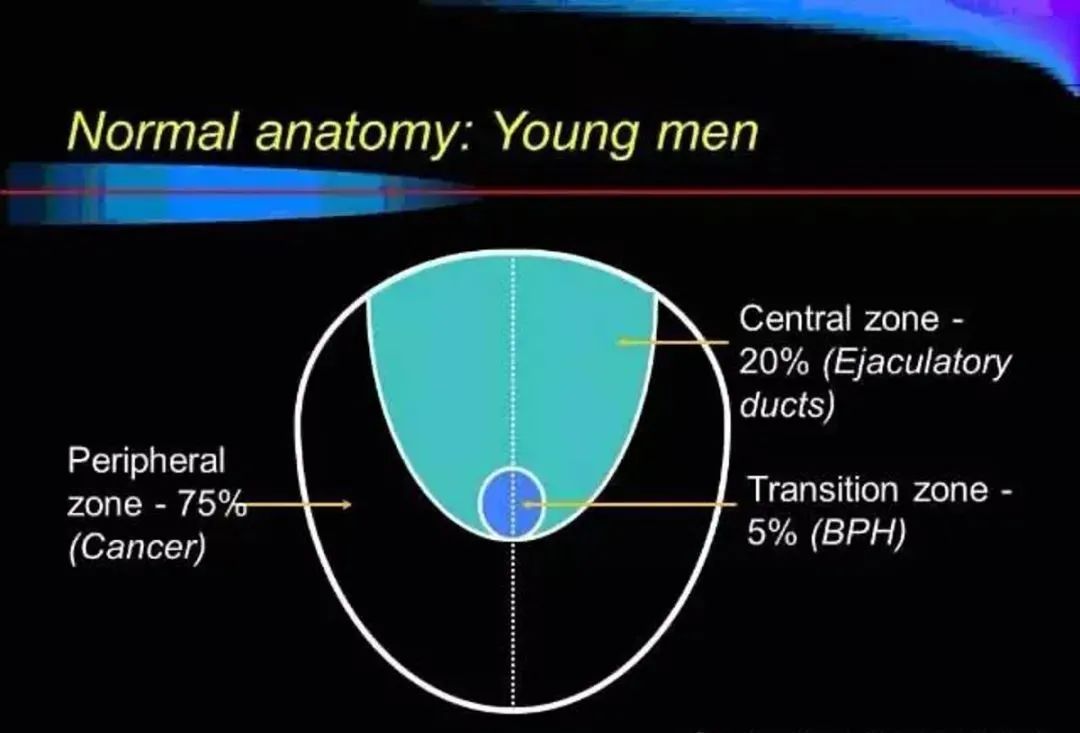 【PPT】前列腺癌MRI诊断再认识-36