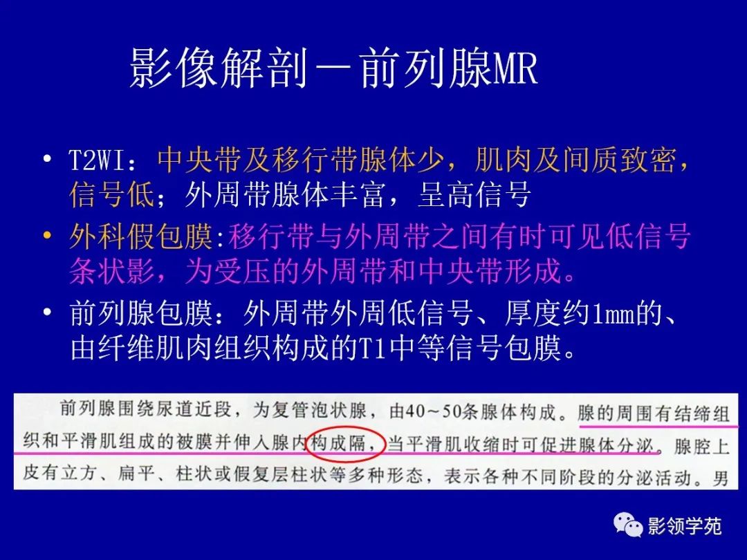 【PPT】前列腺癌MRI诊断再认识-44