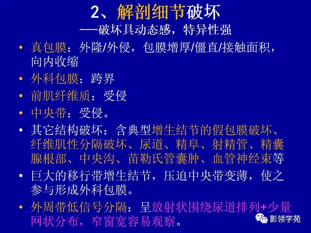 【PPT】前列腺癌MRI诊断再认识-79