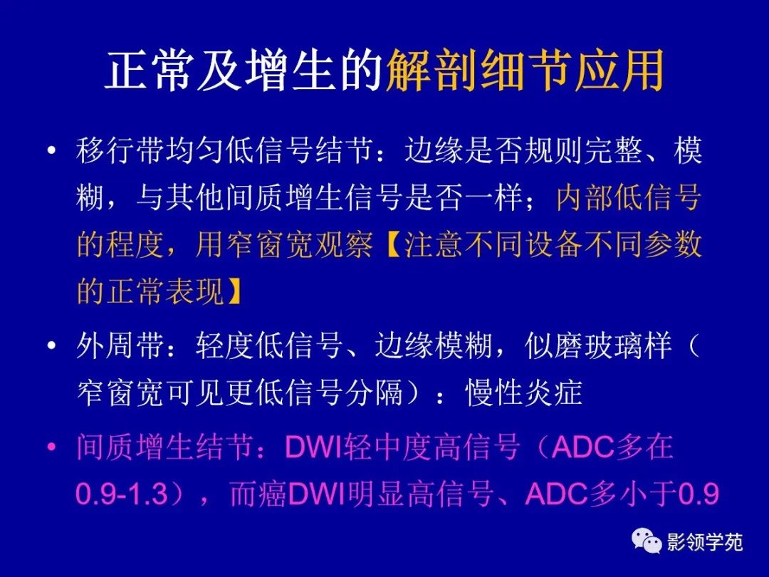 【PPT】前列腺癌MRI诊断再认识-82