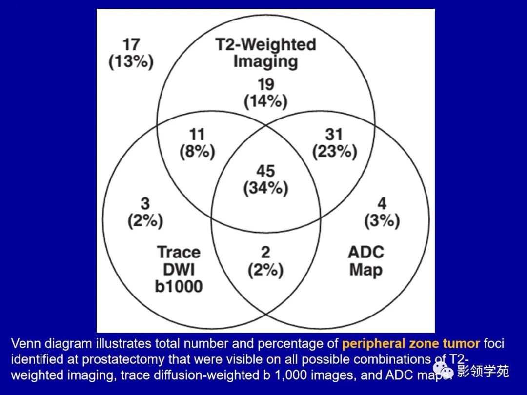 【PPT】前列腺癌MRI诊断再认识-112