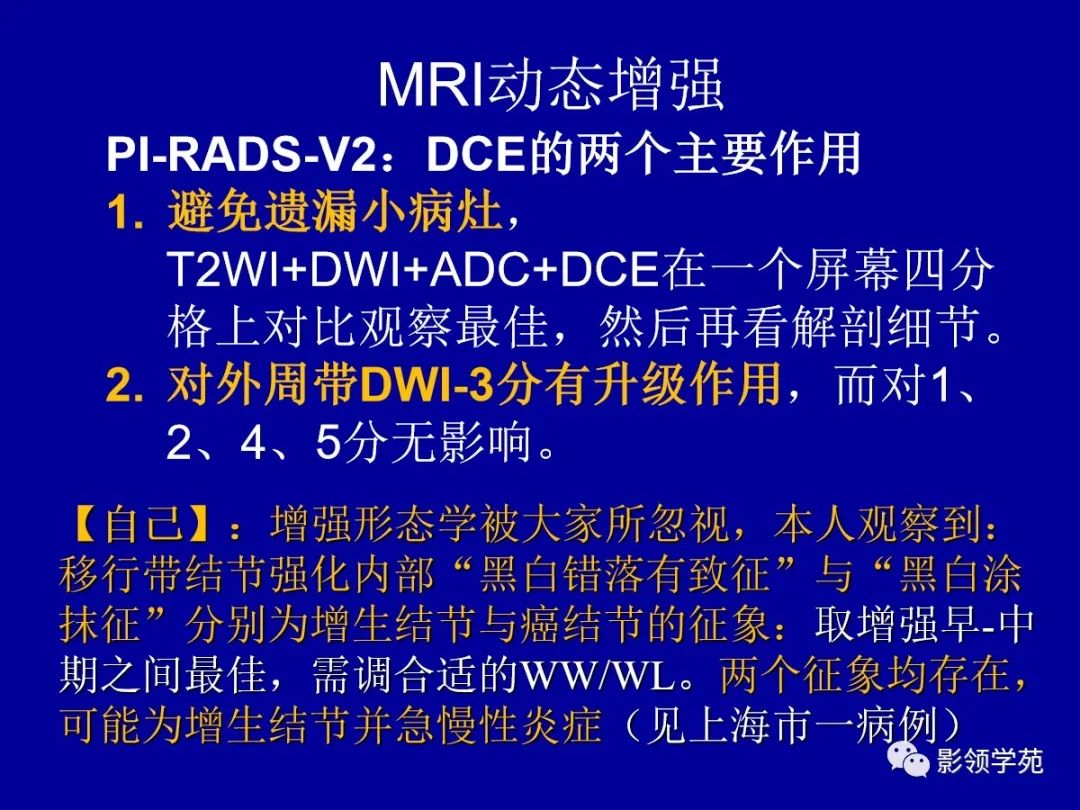 【PPT】前列腺癌MRI诊断再认识-109