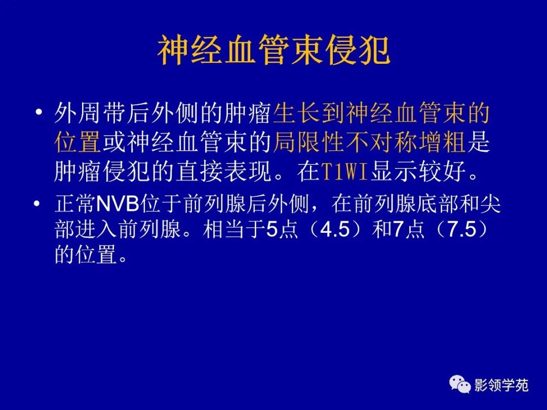 【PPT】前列腺癌MRI诊断再认识-124