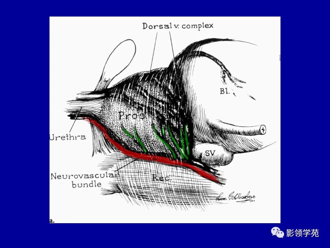 【PPT】前列腺癌MRI诊断再认识-125