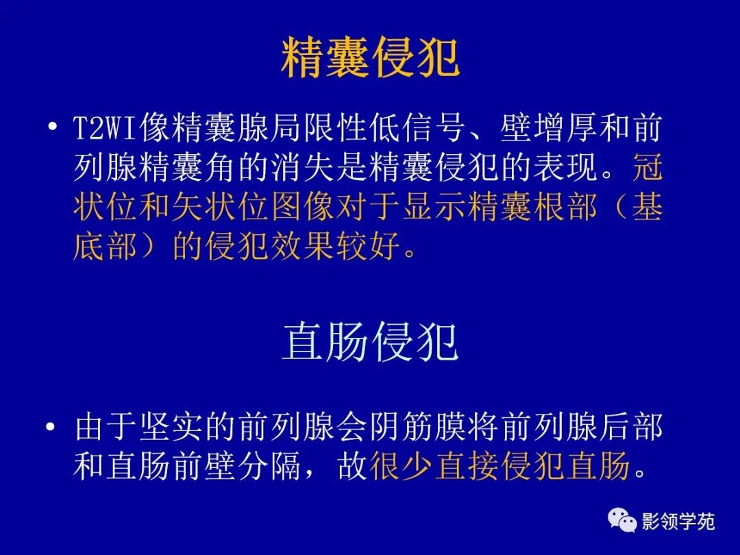 【PPT】前列腺癌MRI诊断再认识-129