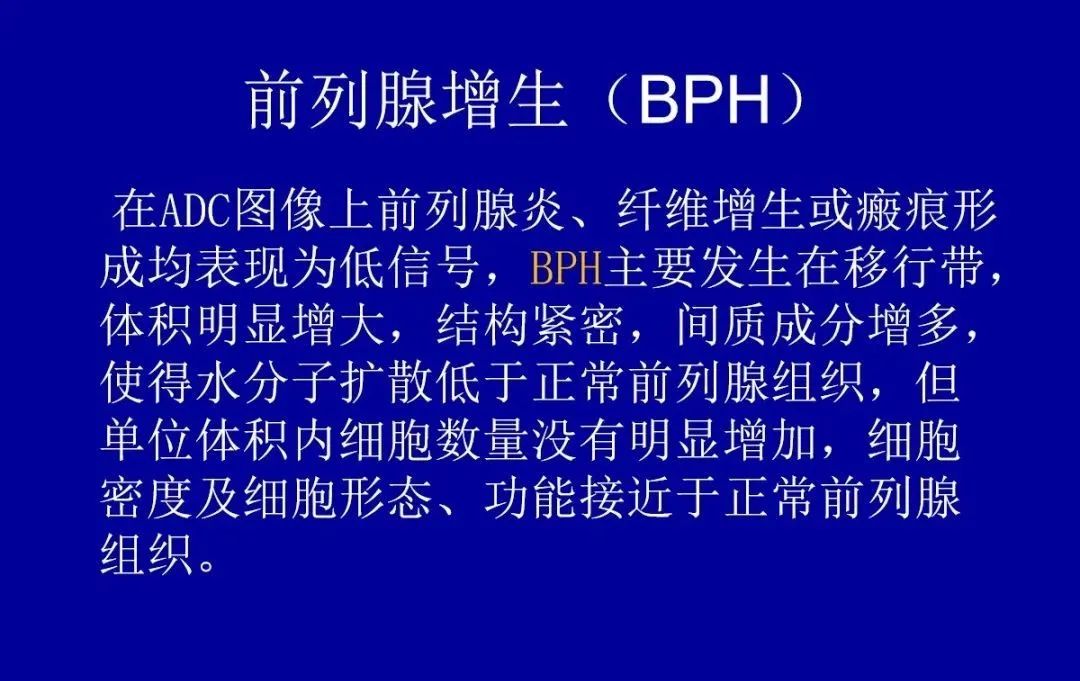 【PPT】前列腺癌MRI诊断再认识-144