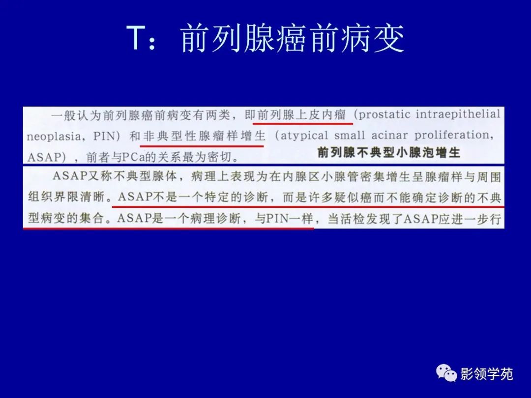 【PPT】前列腺癌MRI诊断再认识-146