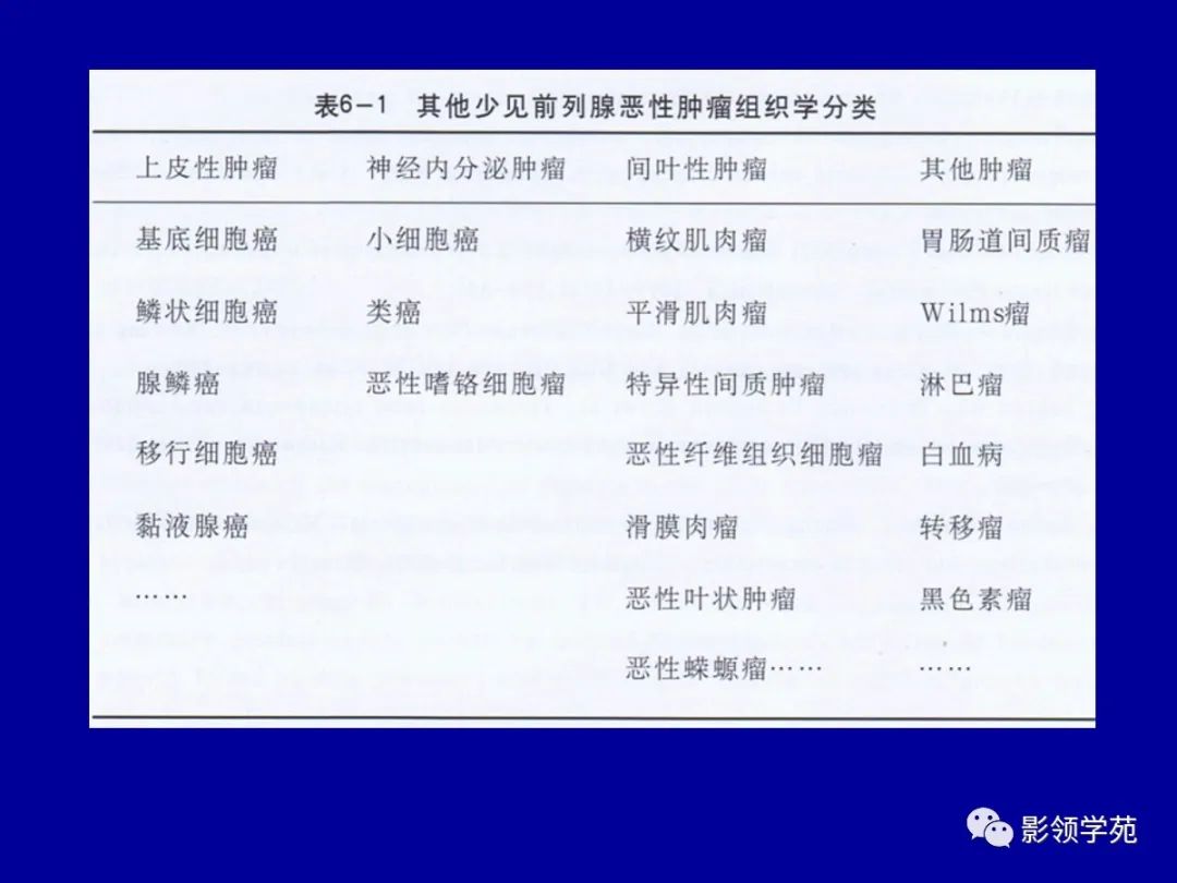 【PPT】前列腺癌MRI诊断再认识-149