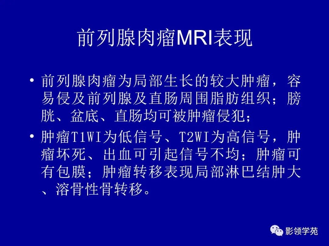 【PPT】前列腺癌MRI诊断再认识-153