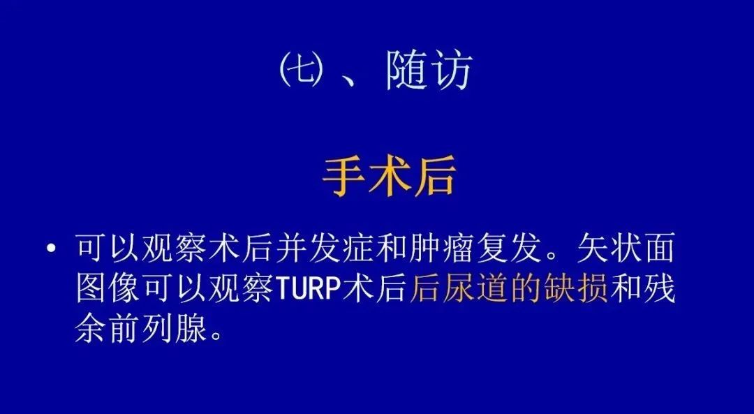 【PPT】前列腺癌MRI诊断再认识-164